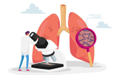 TUBERCULOSIS